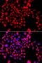 Nucleoporin GLE1 antibody, orb69719, Biorbyt, Immunocytochemistry image 
