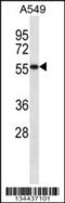 Semenogelin 1 antibody, 57-803, ProSci, Western Blot image 