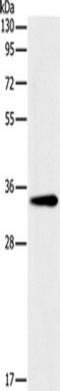 Glycine N-Methyltransferase antibody, TA349527, Origene, Western Blot image 