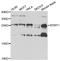 N-Terminal Xaa-Pro-Lys N-Methyltransferase 1 antibody, A10023, Boster Biological Technology, Western Blot image 