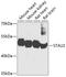 Double-stranded RNA-binding protein Staufen homolog 2 antibody, A05338, Boster Biological Technology, Western Blot image 