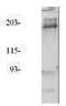 Insulin receptor substrate 2 antibody, PA1-30707, Invitrogen Antibodies, Western Blot image 