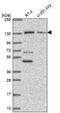 Protein Kinase N2 antibody, NBP2-68736, Novus Biologicals, Western Blot image 