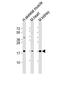 Succinate Dehydrogenase Complex Subunit C antibody, MBS9216068, MyBioSource, Western Blot image 