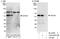 GATA Binding Protein 4 antibody, A303-503A, Bethyl Labs, Immunoprecipitation image 