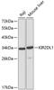 Killer Cell Immunoglobulin Like Receptor, Two Ig Domains And Long Cytoplasmic Tail 1 antibody, 16-818, ProSci, Western Blot image 