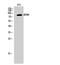 ATR-interacting protein antibody, A03862, Boster Biological Technology, Western Blot image 