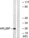 ADP Ribosylation Factor Like GTPase 2 Binding Protein antibody, TA312751, Origene, Western Blot image 