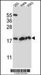 Dihydrofolate Reductase 2 antibody, 57-015, ProSci, Western Blot image 
