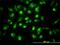 Component Of Oligomeric Golgi Complex 7 antibody, H00091949-M01, Novus Biologicals, Immunocytochemistry image 
