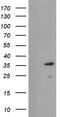 Ubiquitin Conjugating Enzyme E2 J1 antibody, TA504970BM, Origene, Western Blot image 