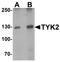 Tyrosine Kinase 2 antibody, LS-B10071, Lifespan Biosciences, Western Blot image 