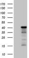 Lysine Methyltransferase 5A antibody, TA808172, Origene, Western Blot image 