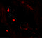 Leucyl And Cystinyl Aminopeptidase antibody, 7055, ProSci Inc, Immunofluorescence image 