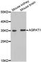 1-Acylglycerol-3-Phosphate O-Acyltransferase 1 antibody, LS-C334770, Lifespan Biosciences, Western Blot image 