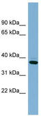 XIAP Associated Factor 1 antibody, TA344996, Origene, Western Blot image 