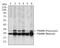 Proteasome Subunit Beta 8 antibody, GTX60486, GeneTex, Western Blot image 