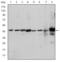 Mitogen-activated protein kinase 3 antibody, STJ98045, St John