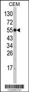 Solute Carrier Family 11 Member 1 antibody, 63-497, ProSci, Western Blot image 