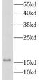 Fatty Acid Binding Protein 2 antibody, FNab02929, FineTest, Western Blot image 