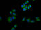 Melanocortin-2 receptor accessory protein antibody, LS-C680889, Lifespan Biosciences, Immunofluorescence image 