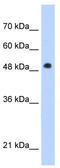 Patatin Like Phospholipase Domain Containing 3 antibody, TA346840, Origene, Western Blot image 