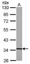 2,4-Dienoyl-CoA Reductase 1 antibody, PA5-30878, Invitrogen Antibodies, Western Blot image 