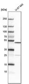 AlkB Homolog 5, RNA Demethylase antibody, PA5-52401, Invitrogen Antibodies, Western Blot image 