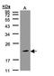 Killer Cell Lectin Like Receptor C4 antibody, LS-C185995, Lifespan Biosciences, Western Blot image 