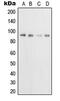 Transferrin Receptor antibody, MBS822109, MyBioSource, Western Blot image 