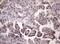 Late Cornified Envelope Like Proline Rich 1 antibody, NBP2-45616, Novus Biologicals, Immunohistochemistry paraffin image 