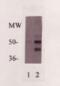 C-Reactive Protein antibody, XG-6176, ProSci, Western Blot image 