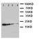 Growth Hormone 1 antibody, LS-C313474, Lifespan Biosciences, Western Blot image 