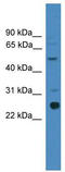 Zinc Finger Matrin-Type 2 antibody, TA343993, Origene, Western Blot image 