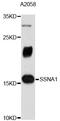 Sjoegren syndrome nuclear autoantigen 1 antibody, STJ26585, St John