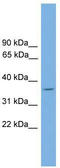 DnaJ Heat Shock Protein Family (Hsp40) Member C17 antibody, TA329989, Origene, Western Blot image 