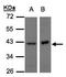 NADH:Ubiquinone Oxidoreductase Subunit A10 antibody, LS-C185521, Lifespan Biosciences, Western Blot image 