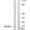 Nuclear Cap Binding Protein Subunit 2 antibody, A08031, Boster Biological Technology, Western Blot image 