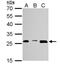 Proteasome 20S alpha 3 antibody, NBP1-33537, Novus Biologicals, Western Blot image 