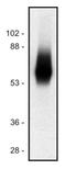 T Cell Receptor Associated Transmembrane Adaptor 1 antibody, SM3077P, Origene, Western Blot image 