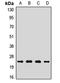 Mitochondrially Encoded Cytochrome C Oxidase II antibody, LS-C668489, Lifespan Biosciences, Western Blot image 
