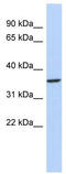 Pituitary homeobox 3 antibody, TA332081, Origene, Western Blot image 