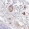 Insulin Like Growth Factor 1 antibody, HPA048946, Atlas Antibodies, Immunohistochemistry frozen image 