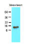 A-FABP antibody, AM09048PU-S, Origene, Western Blot image 
