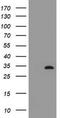 Inhibitor Of Growth Family Member 2 antibody, TA800665S, Origene, Western Blot image 