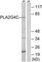 Phospholipase A2 Group IVC antibody, TA314779, Origene, Western Blot image 