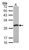 Protein-L-Isoaspartate (D-Aspartate) O-Methyltransferase antibody, NBP1-33019, Novus Biologicals, Western Blot image 