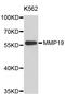 Matrix Metallopeptidase 19 antibody, STJ24582, St John