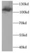 Chloride Voltage-Gated Channel 1 antibody, FNab10163, FineTest, Western Blot image 