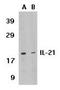 Interleukin-21 antibody, TA306076, Origene, Western Blot image 